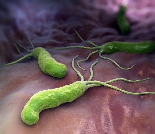 Afectiunile digestive – Helicobacter Pylori Afectiunile digestive - Helicobacter Pylori